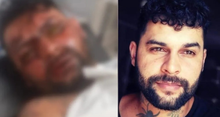 mulher-joga-soda-caustica-no-rosto-de-ex-e-rezava-para-ele-ficar-cego