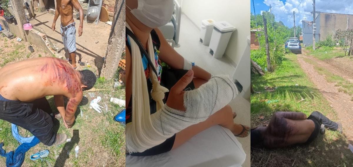 agressor-que-arrancou-dedos-da-mulher-com-golpes-de-faca-leva-“salve”-de-faccao-e-e-preso