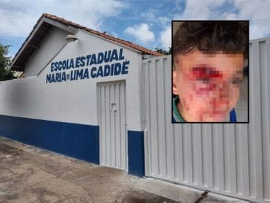vereador-denuncia-bullying-e-agressao-a-aluno-dentro-de-escola-e-critica-conselheiro