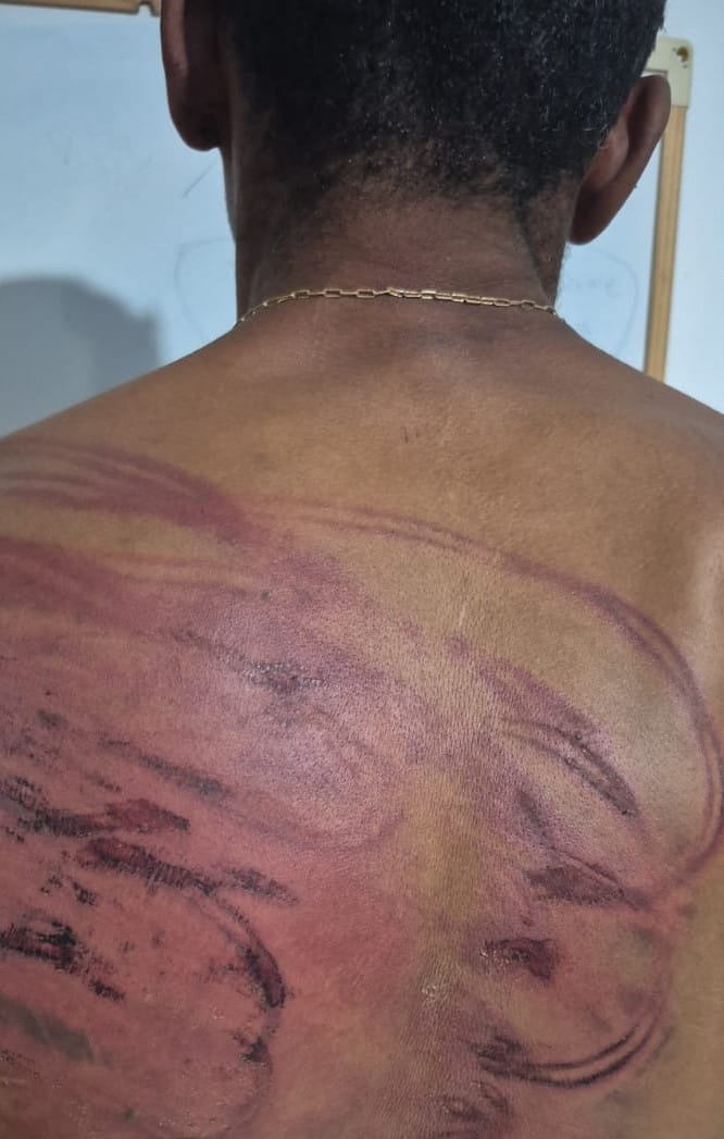 faccionados-torturam-homem-com-mangueira-e-tentam-degola-lo-em-mt